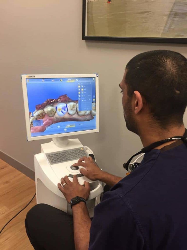 South Calgary dental office using a digital scanner for dental crowns